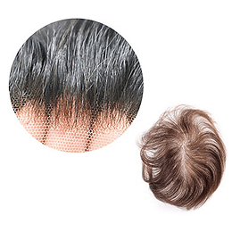 Men hair density image