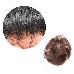 Men hair density image