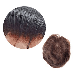 Men hair density image
