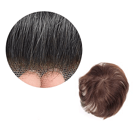 Men hair density image