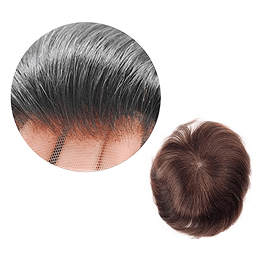Men hair density image
