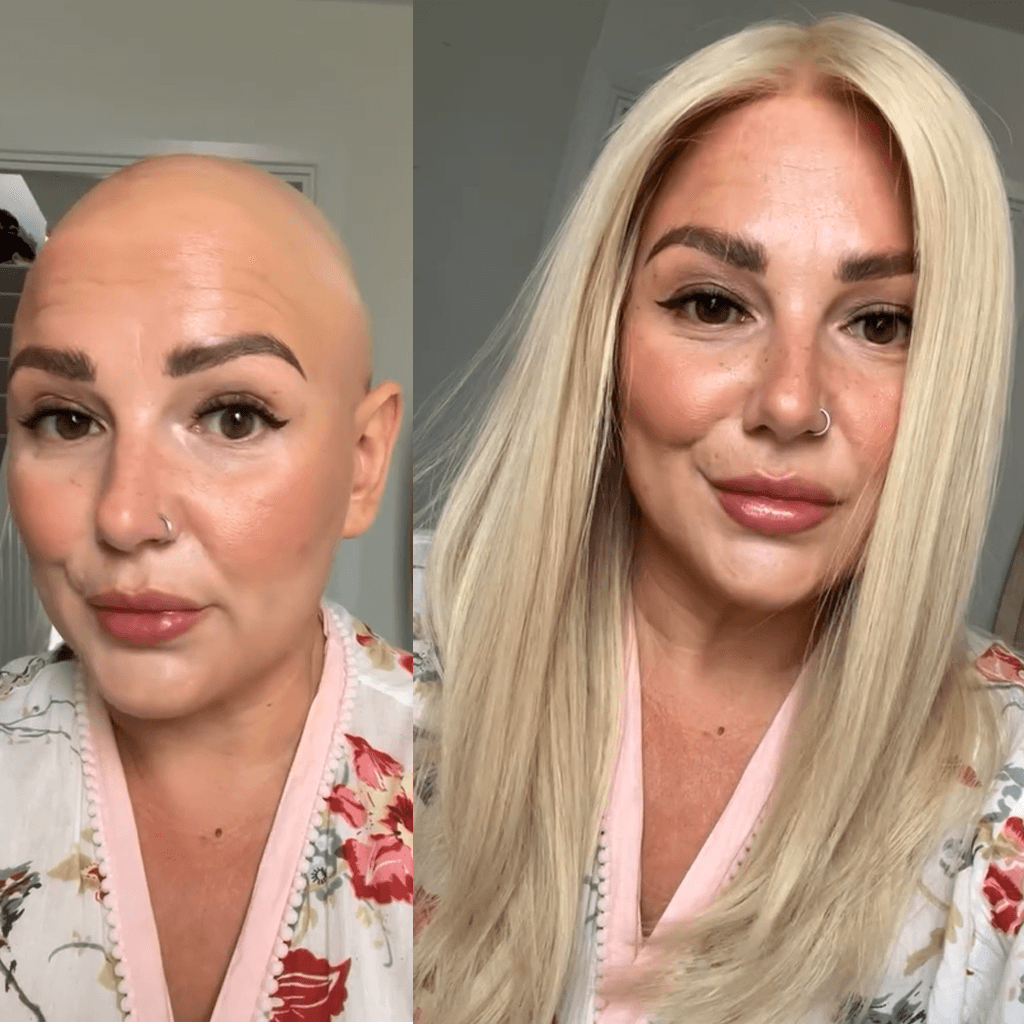 Women before After Image