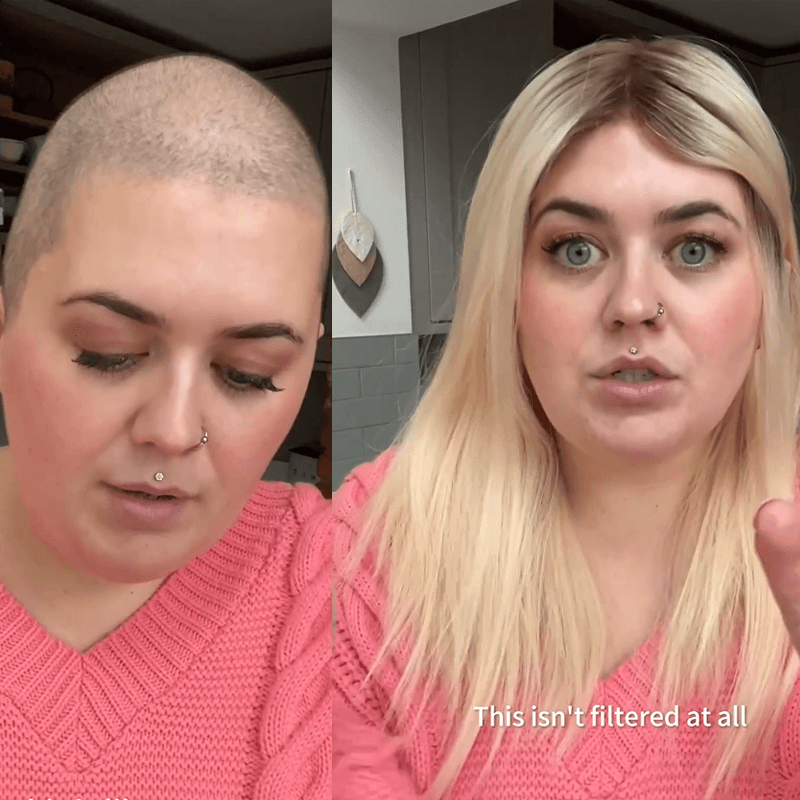 Women before After Image