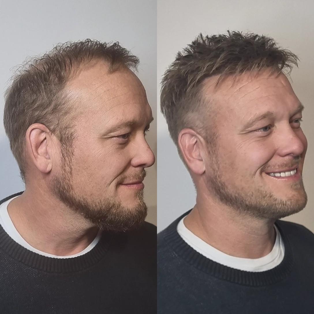 before-after