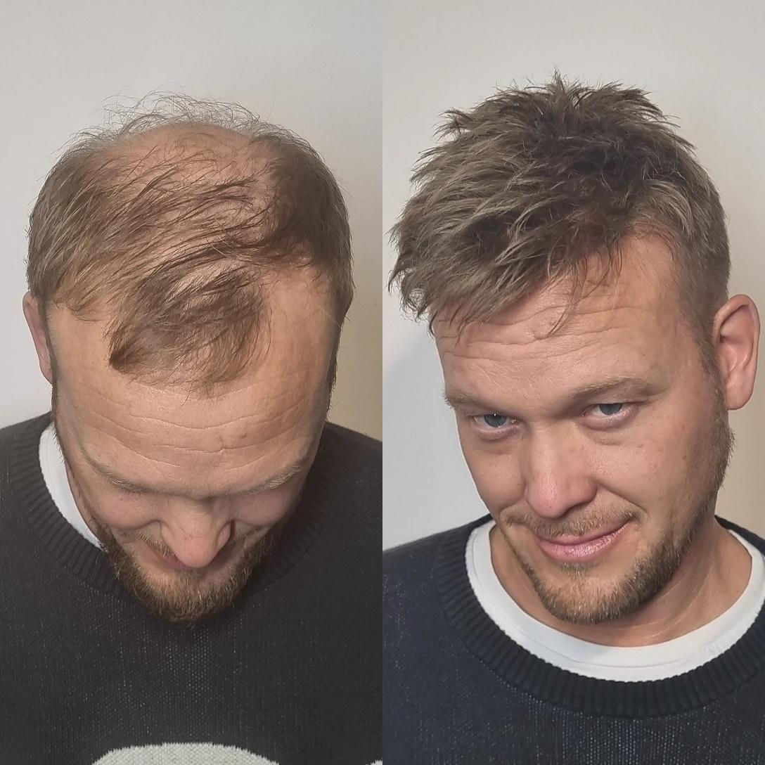 before-after