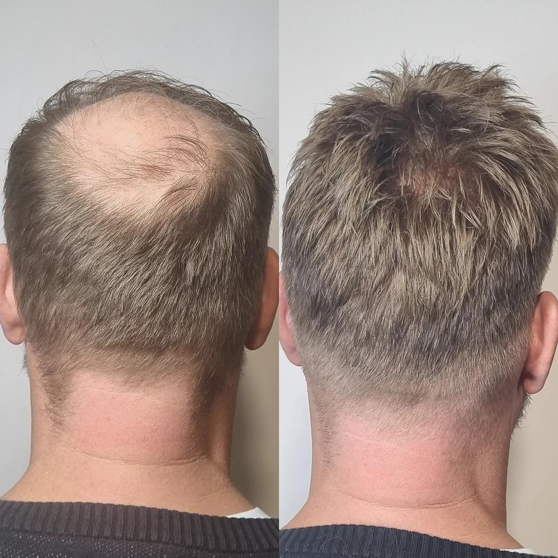 before-after