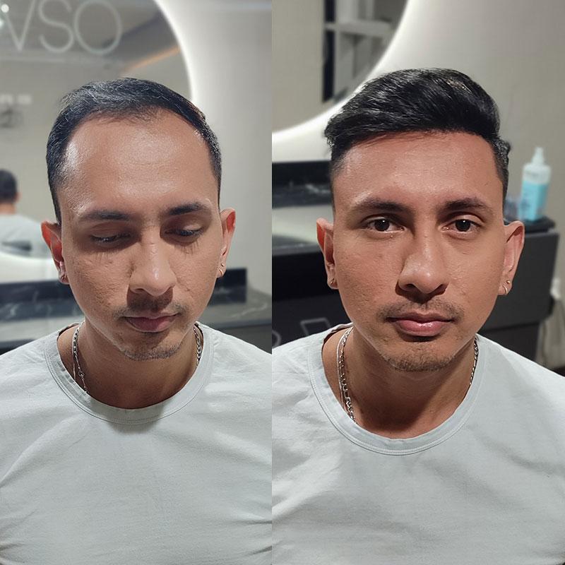 Hair System Before After Image