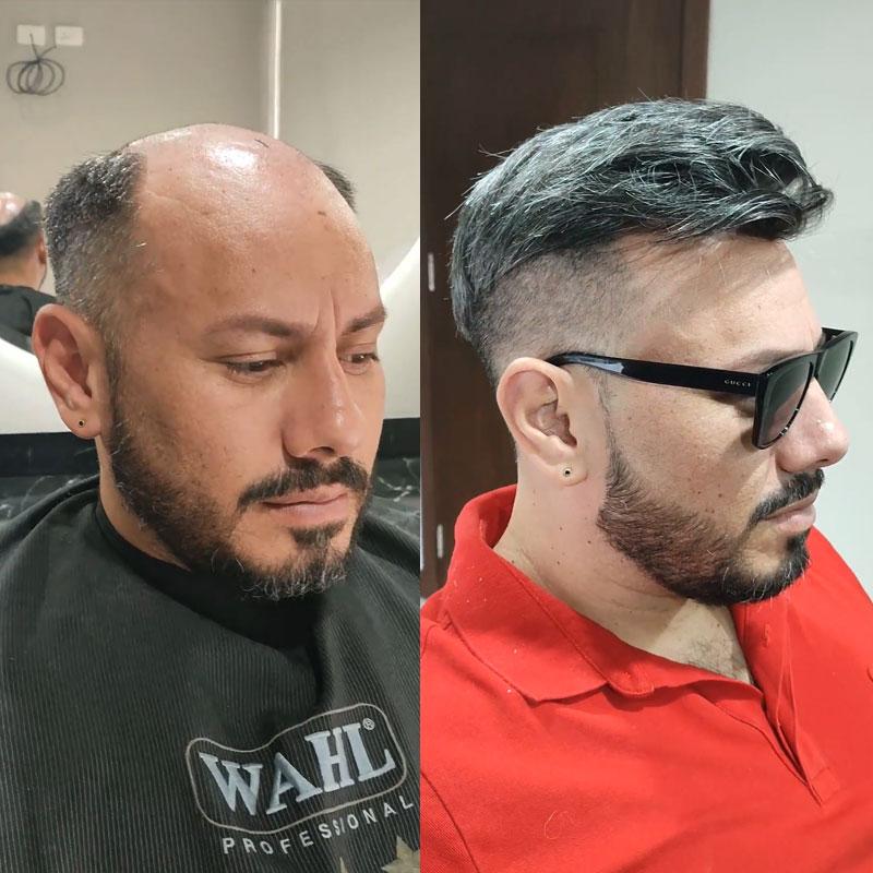 Hair System Before After Image