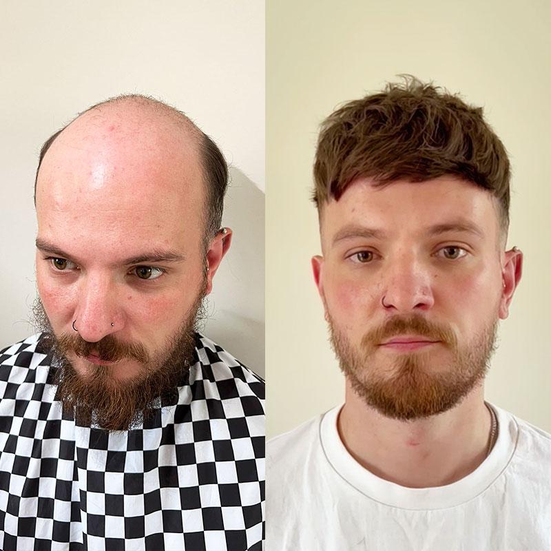 Hair System Before After Image