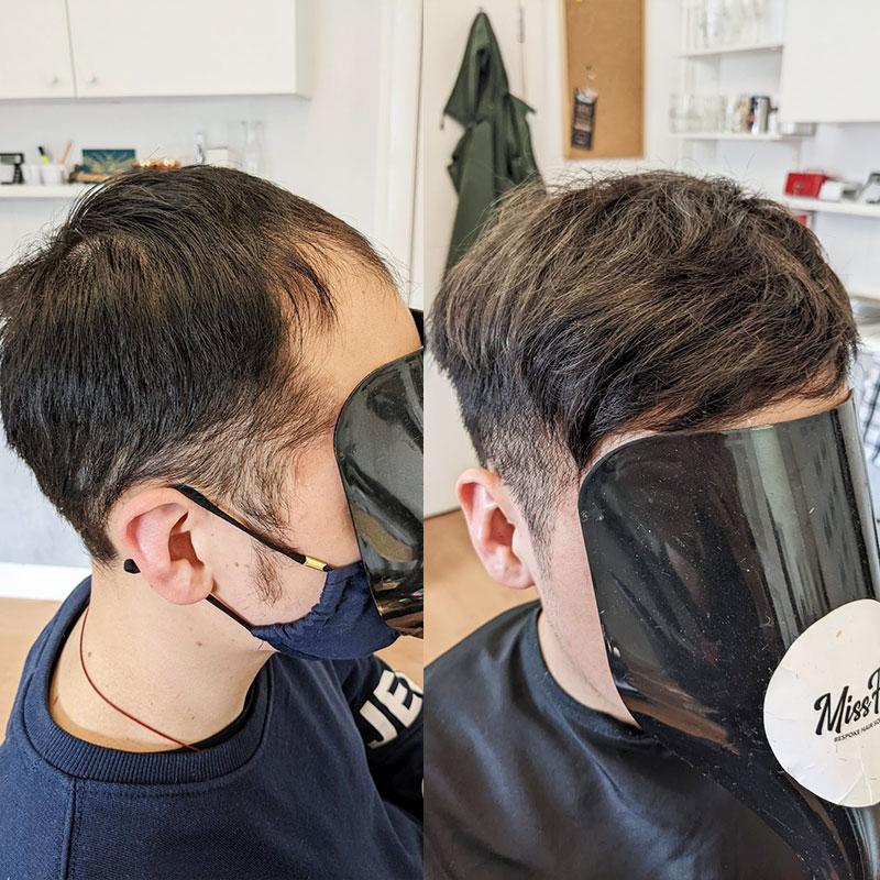 Hair System Before After Image
