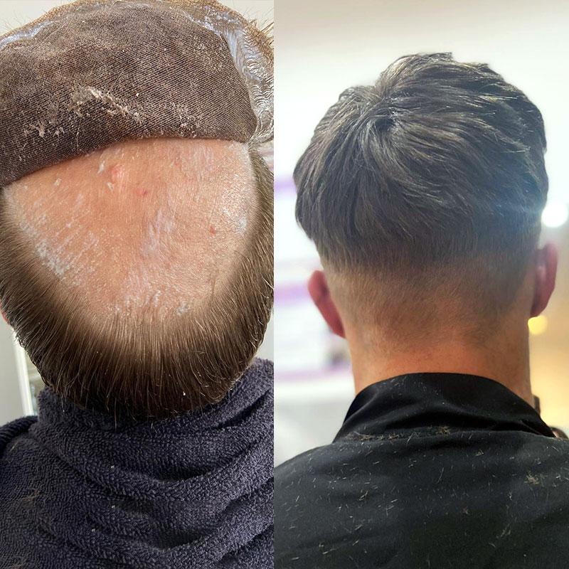 Hair System Before After Image