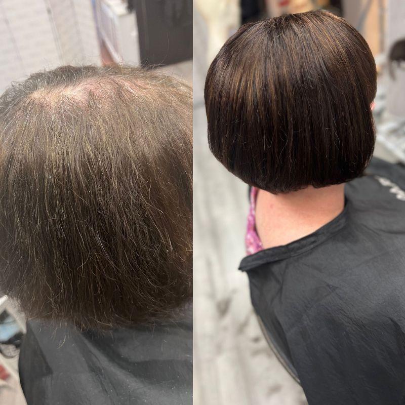 Topper before After Image