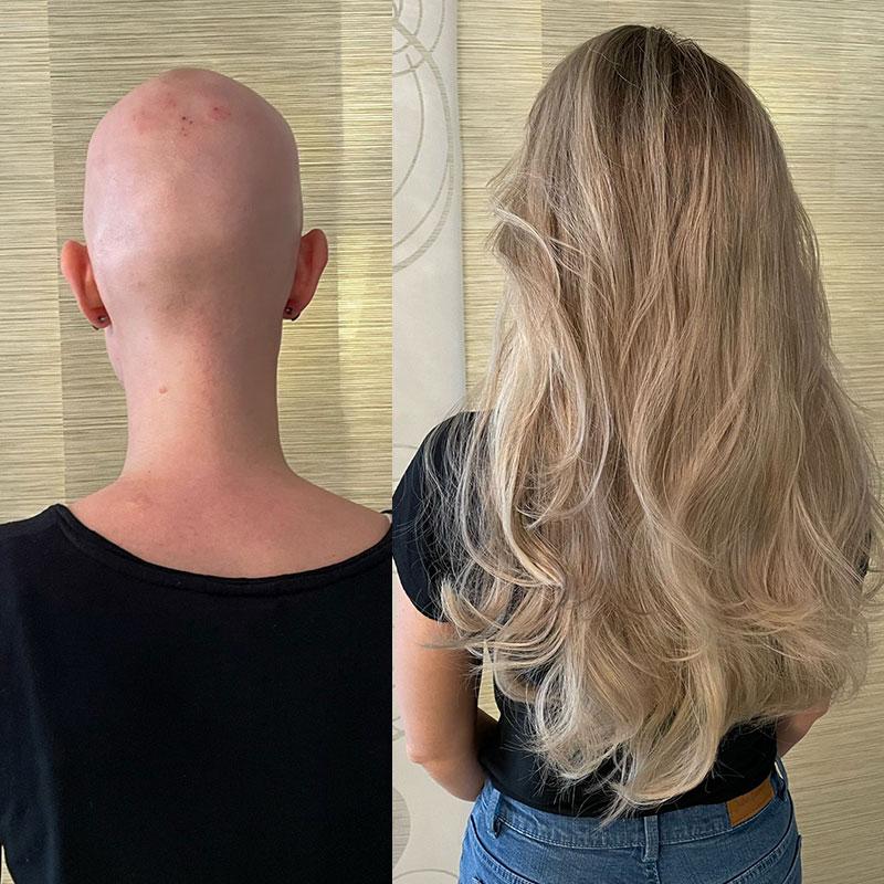 Women before After Image