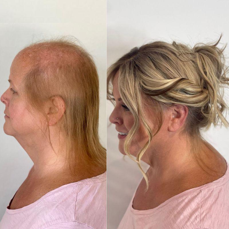 Topper before After Image