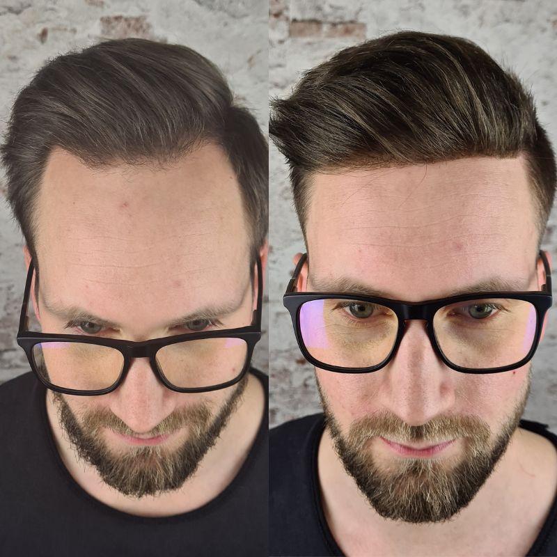 Hair System Before After Image