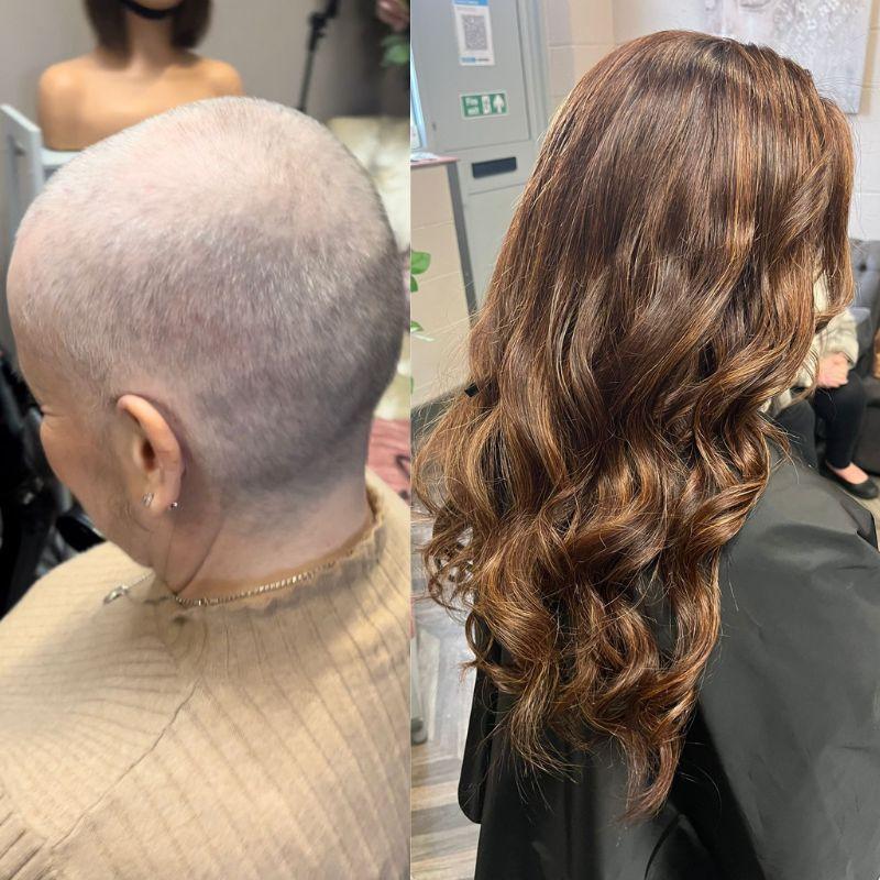 Women before After Image