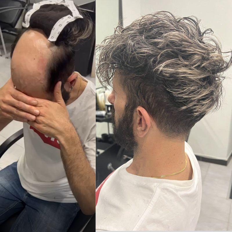 Hair System Before After Image