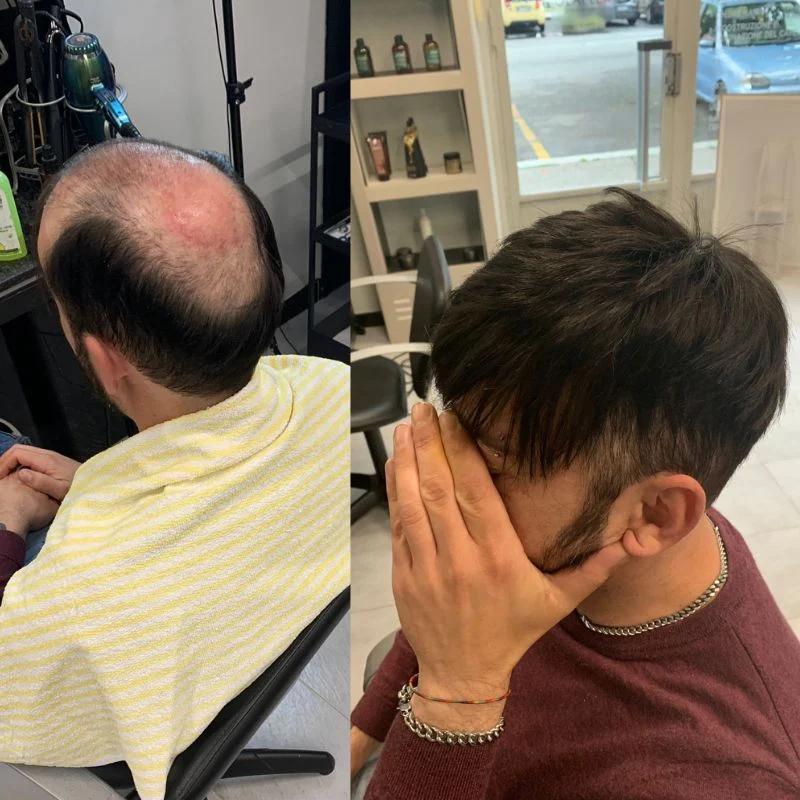 Hair System Before After Image