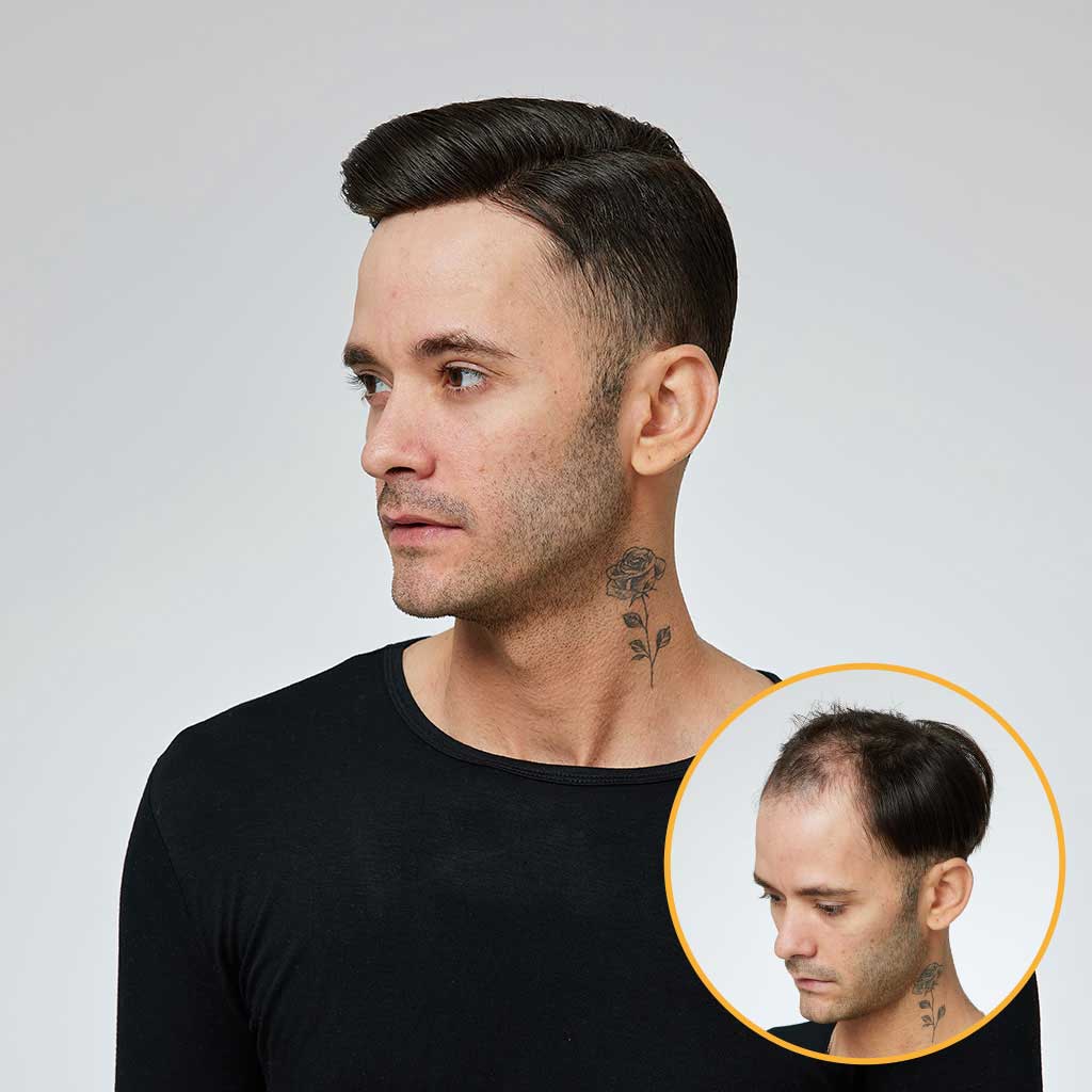 Q6 French Lace Hair Systems with Clear PU Back Sides (13)