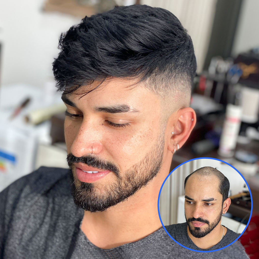0.08mm Thin Skin Hair System