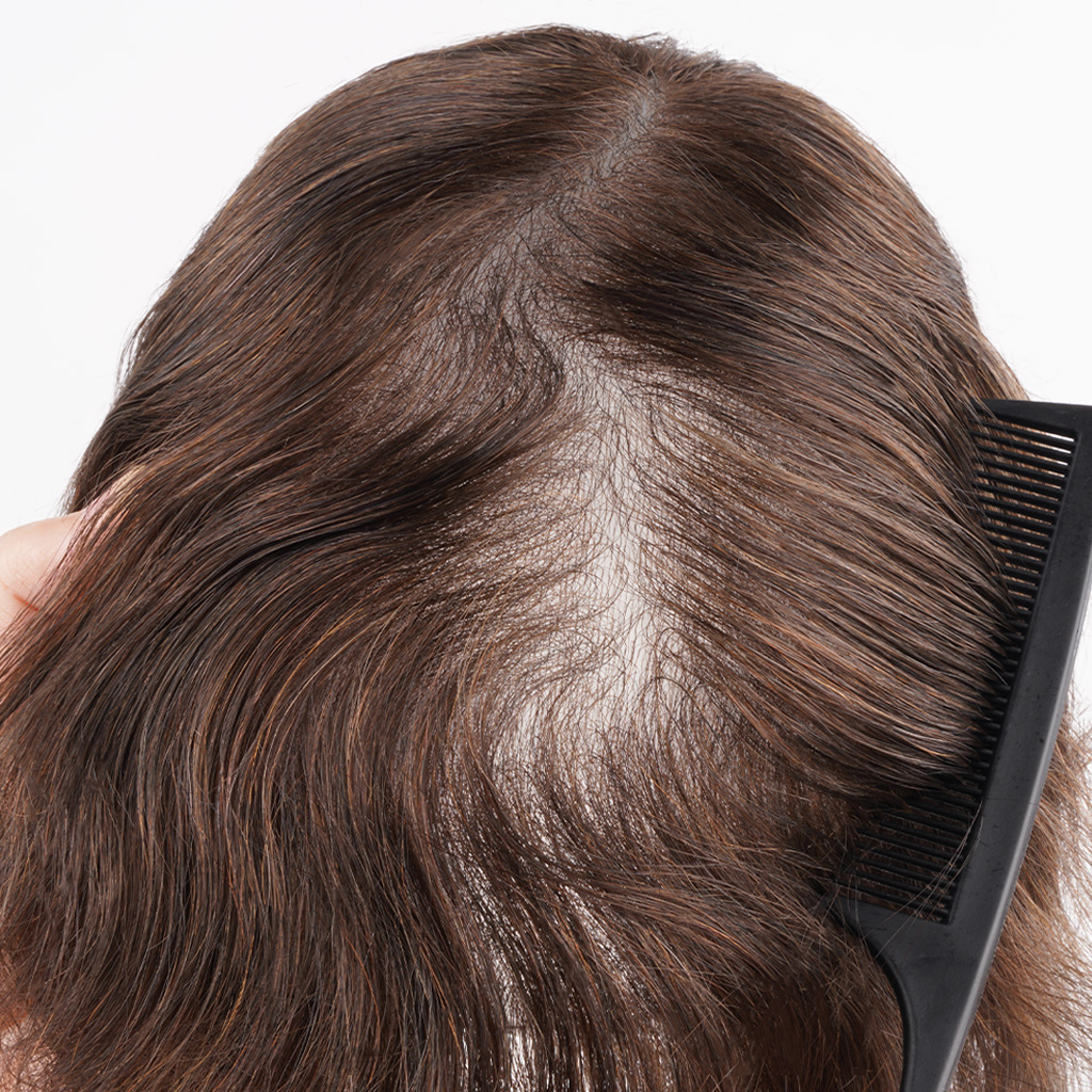 LIGHT03 thin skin hair system at ideally light hair density